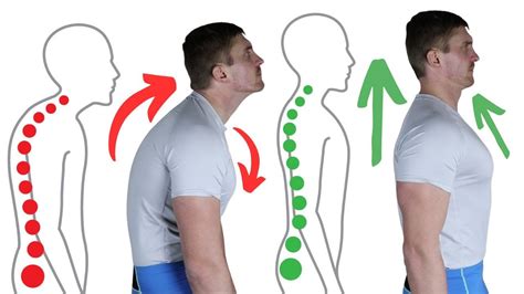 Unlock your best posture: How to fix hunchback - YouTube