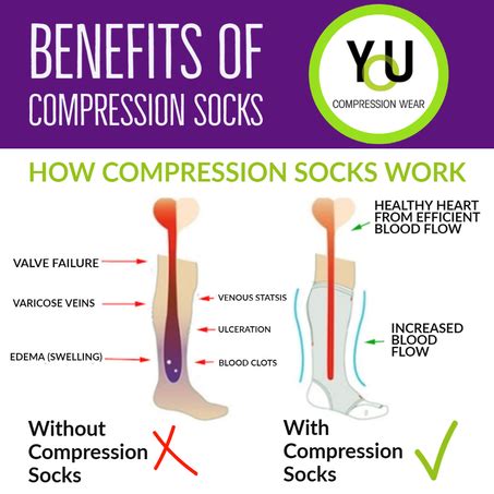 Compression Socks, Stockings & Pants - EDMONTON VEIN CLINIC