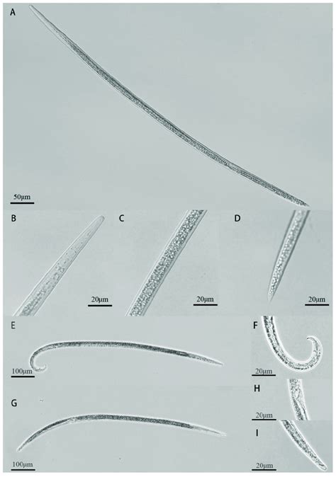 Morphological characteristics of Bursaphelenchus xylophilus isolated... | Download Scientific ...