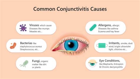 Eye Cold - Contagious Conjunctivitis You Ought to Know About