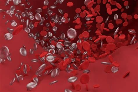 Injectable drug may reduce bleeding in patients with hemophilia - UPI.com