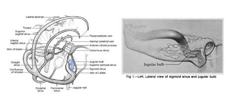 Cerebral metabolic demand | Deranged Physiology