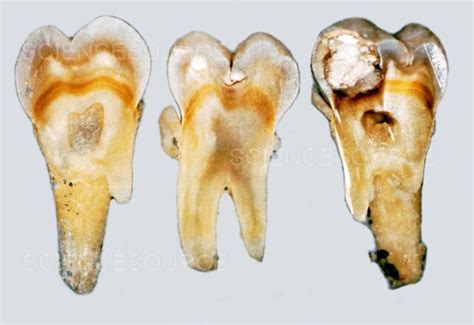 Photograph | Tetracycline Staining | Science Source Images