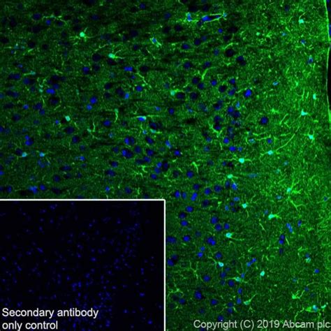 Astrocyte markers | Abcam