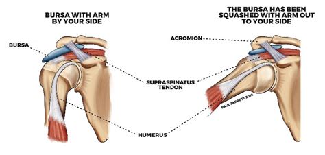 Shoulder Exercise For Swimmers: Swim Stroke Technique & Shoulder Pain | Central Performance