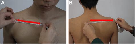 Measurement of the scapula index. (A) Measurement of the distance... | Download Scientific Diagram