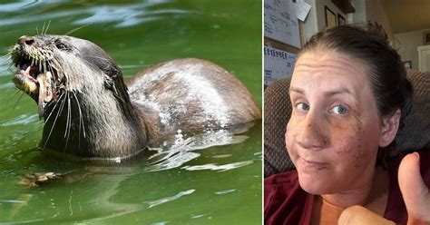 Woman has part of her ear bitten off in extremely rare otter attack | US News | Metro News