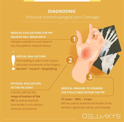 What To Do About Proximal Interphalangeal (PIP) Joint Pain? - Cellaxys