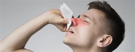 Nosebleed causes and how to prevent | Harley Street ENT Clinic