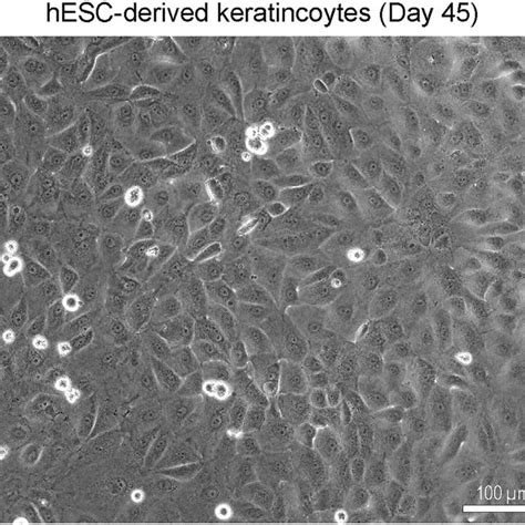 Keratinocytes at day 45 of differentiation Bright field image showing... | Download Scientific ...