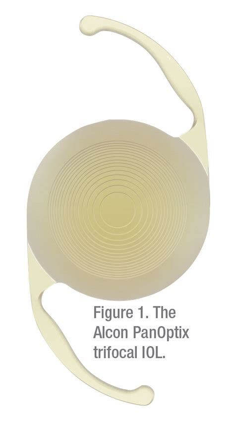 Trifocals and EDOFs: Where Do They Stand?