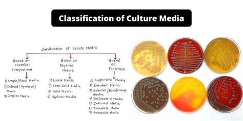 What Is Culture Media Different Classification Of Culture Media Microbiology – NBKomputer