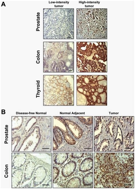 A. Representative images of immunohistochemical staining (low ...