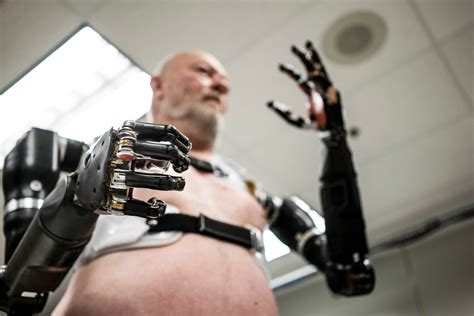 Atom Limbs 🦾 The first artificial human arm