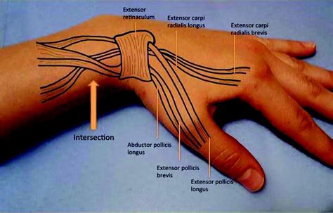 Proximales Handgelenk