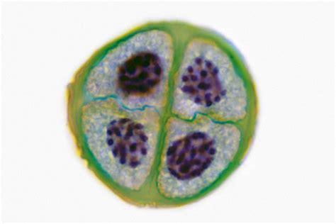 Overview of the Stages of Meiosis