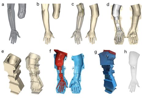 Design and fabrication process for the prosthetic arm. (a) The affected ...