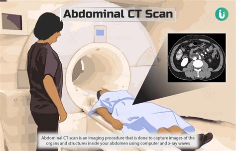 Abdominal CT Scan (whole abdomen): Procedure, Purpose, Results, Normal Range, Cost, Price ...