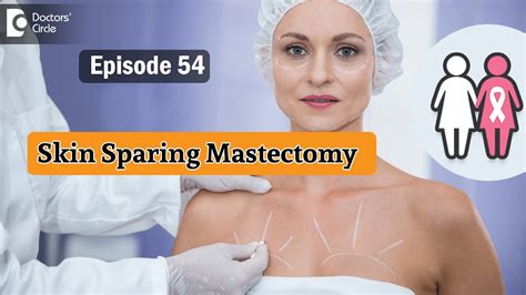 SKIN SPARING MASTECTOMY In Breast Cancer Treatment Nayak , 53% OFF