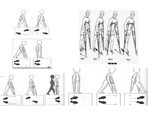 Gait Patterns with Crutches Quiz