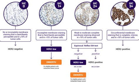 About HER2-low | ENHERTU® (fam-trastuzumab deruxtecan-nxki) | For HCPs