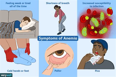 Causes and Symptoms of Iron Deficiency Anemia and Diet Plan to Fight with