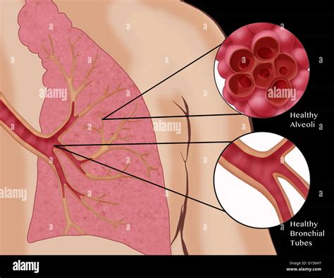 Bronchial Tube Stock Photos & Bronchial Tube Stock Images - Alamy