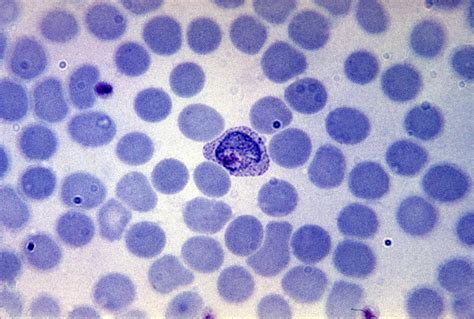 Free picture: blood smear, growing, trophozoite, plasmodium vivax