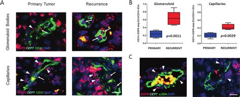 Combined immunofluorescence for endothelial/pericyte markers and FISH ...