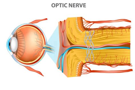 Optic Nerve - All About Vision