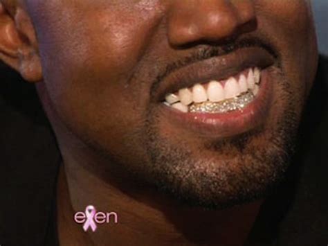 Kanye West Shows Ellen His Diamond Grill | Media Crumbs