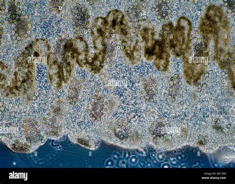 Stinging cells (nematocysts) in the tentacles of the Lion's Mane ...