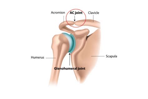 Acromioclavicular Joint Pain - Shoulder Pain - Complete Physio