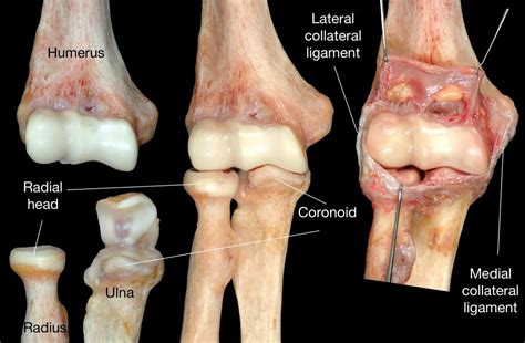 Elbow bones and ligaments - Shoulder & Elbow