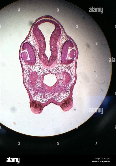 Chick embryo microscopic slide image. Image taken from the microscope Stock Photo - Alamy