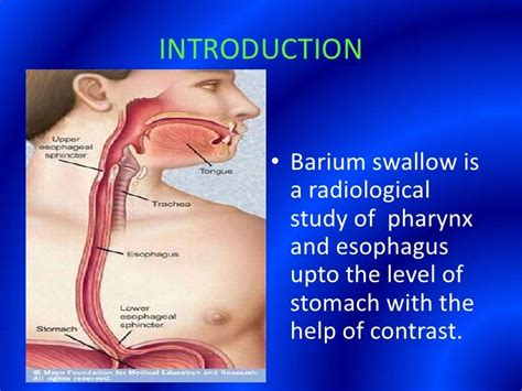 Barium Swallow Presentation