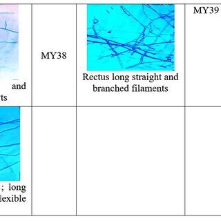 Microscopic spore profile of Streptomyces isolates | Download ...