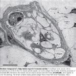 Electron Micrograph of a Golgi Tendon Organ In Transverse Section