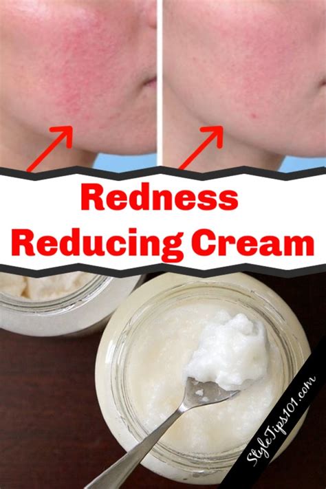 DIY Redness Reducing Cream