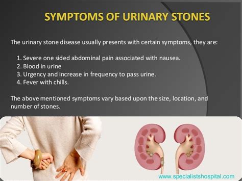 Urinary Stones Treatment - Your Ultimate Guide