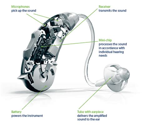 Phonak Hearing Aid Parts Diagram | Reviewmotors.co