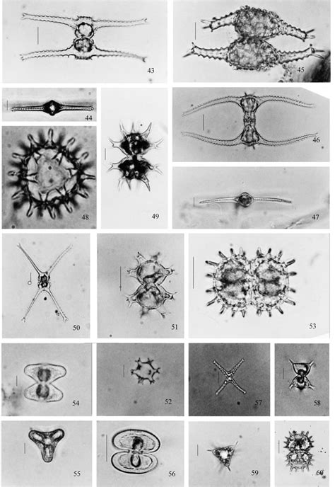 Espécies de Staurastrum e Xanthidium da lagoa do Caçó. 43. S.... | Download Scientific Diagram