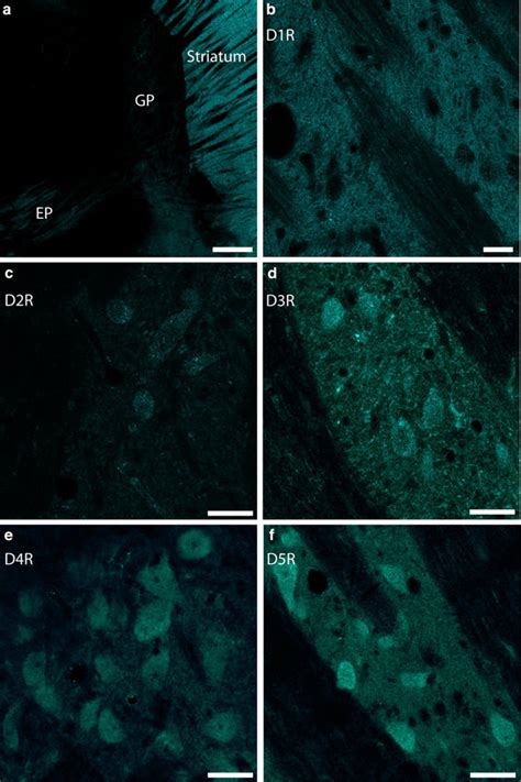 All dopamine receptors are expressed in the EP. a A sagittal slice from... | Download Scientific ...