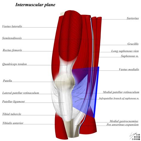 Medial Patellar Retinaculum Injury