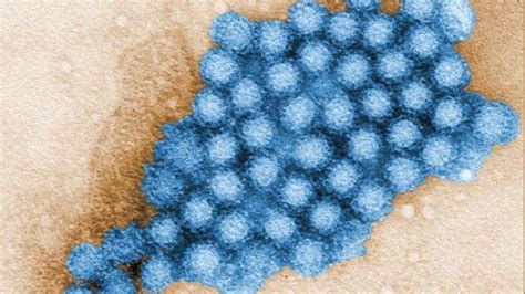 New Norovirus Strain Rips Through The U.S. : Shots - Health News : NPR