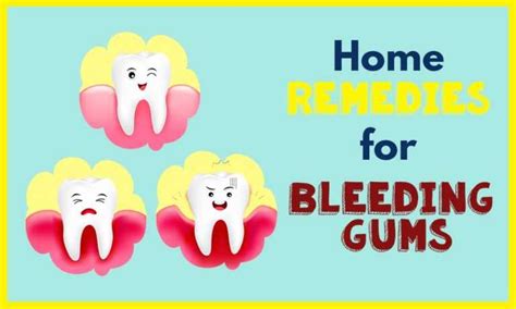 How to Treat Bleeding Gums with Home Remedies