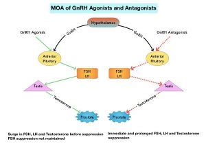 Oral Relugolix Superior to Leuprolide in Advanced Prostate Cancer ...