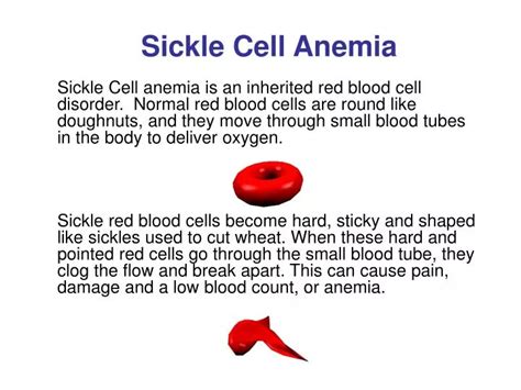 PPT - Sickle Cell Anemia PowerPoint Presentation, free download - ID:1217270