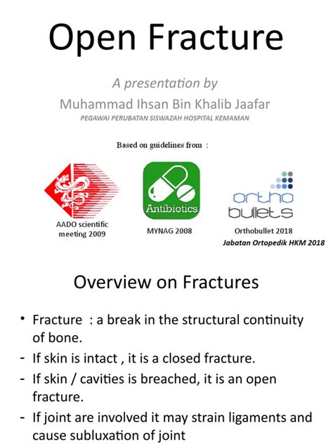 Management of Open Fractures: A Comprehensive Review of Guidelines and ...