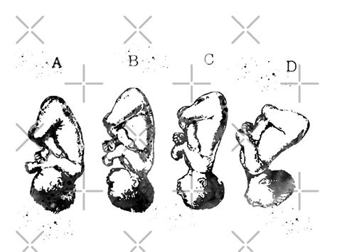 "Cephalic position" by erzebetth | Redbubble